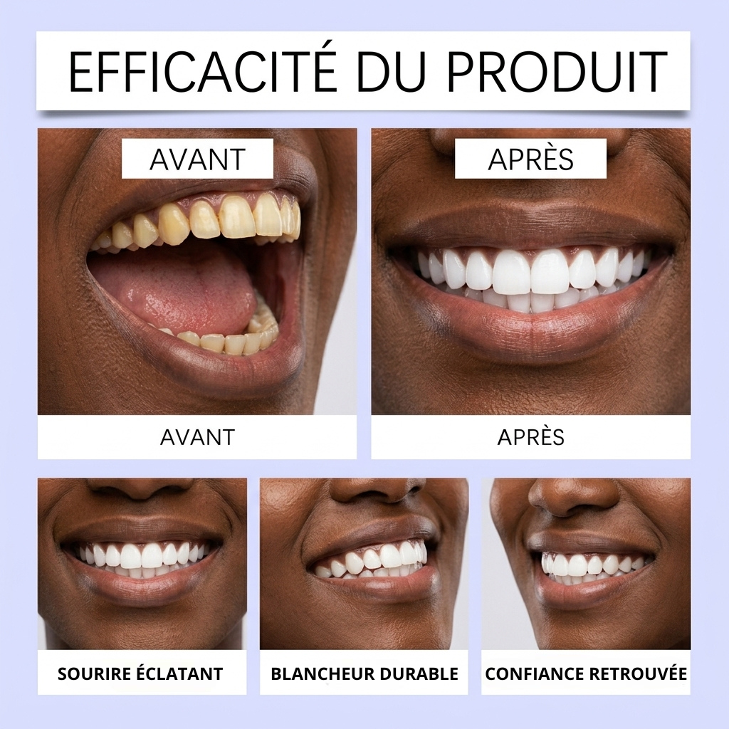 PureWhite™ — Bandes Blanchissantes Dents