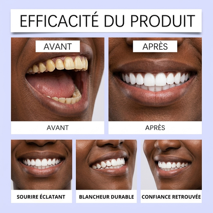 PureWhite™ — Bandes Blanchissantes Dents